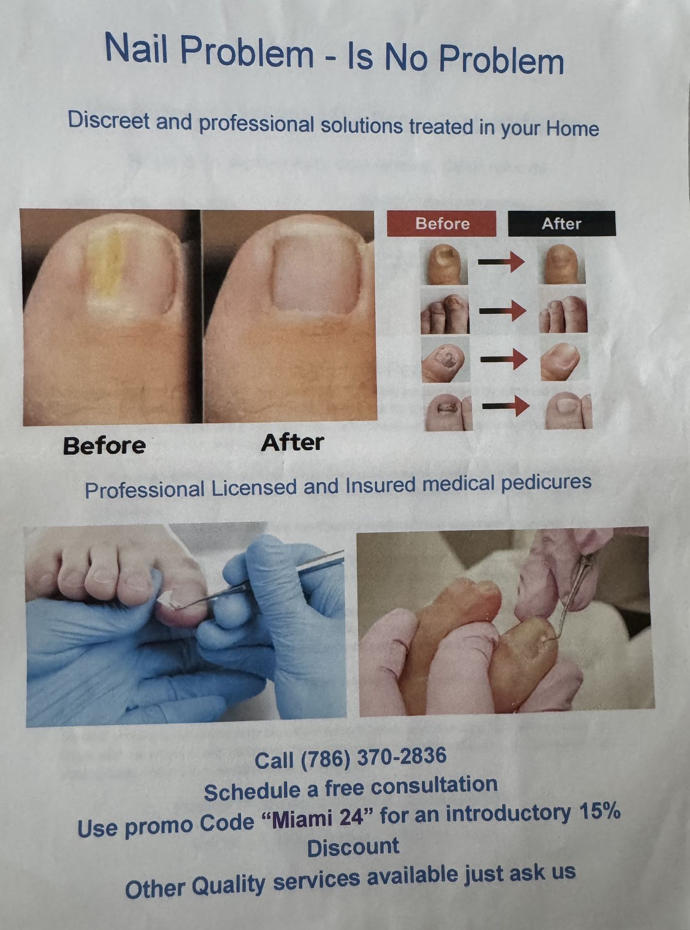 Nail Problem - Is No Problem