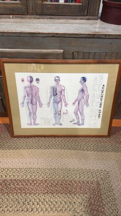 Acupuncture chart