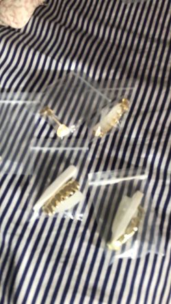 18k gold plated grillz