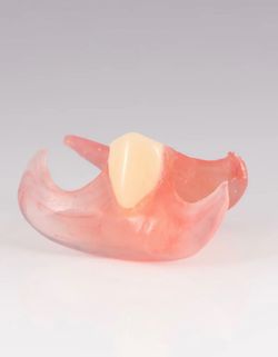 Denture Repair