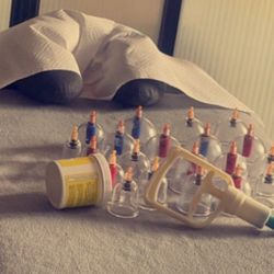 Cupping —-Terapeuta a nivel Familiar 🙏🏽