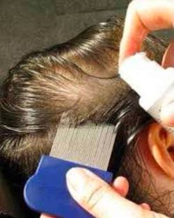 REPELANTE PARA ELIMINAR PIOJOS Y LIENDRES