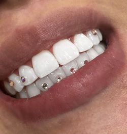 Quality Tooth Gems + Warranty 💎 ✨ 