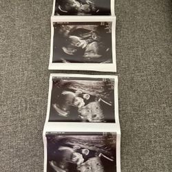 Baby Ultrasound/ Gender Reveal