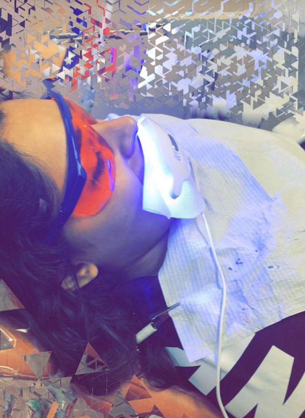 Teeth whitening light accelerator for Sale in Pearland, TX - OfferUp