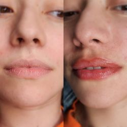 Lipblush