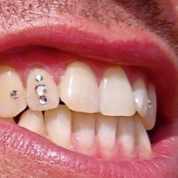 Tooth Gems 💎