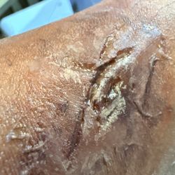 Fake Prosthetic Appliance