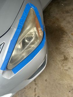 Light restoration $80