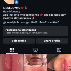 Lip Fillers 💋💄