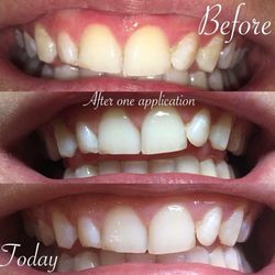 Whitening toothpaste