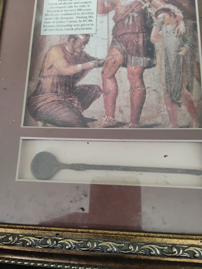 Greco-Roman Surgical Tool Date Approx 200 Ad