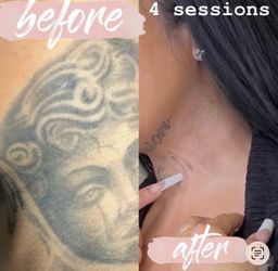 Ink Removal