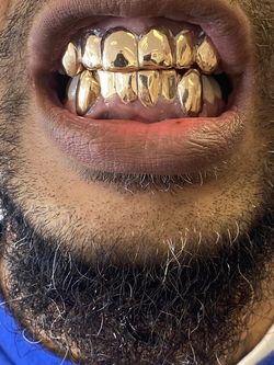 Gold Grillz