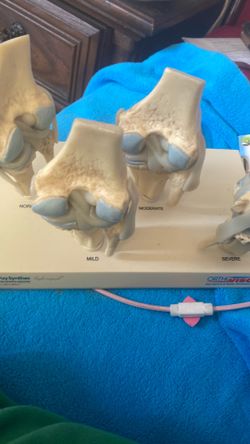 Knee model degeneration