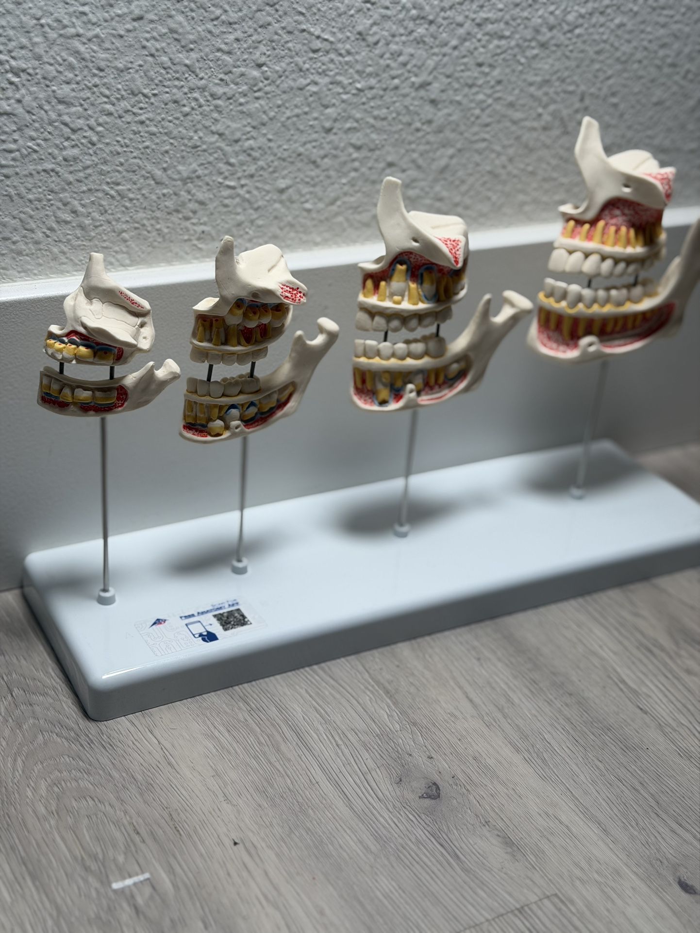 3B Scientific Dentition Development Model - 4 Stages Dental Teeth Development Education Model