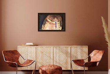 Oil Painting On Canvas