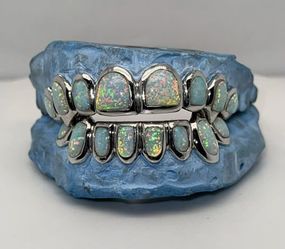 🔥 Custom-Fit Opal & Moissanite Grillz