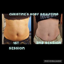 Body Sculpting 