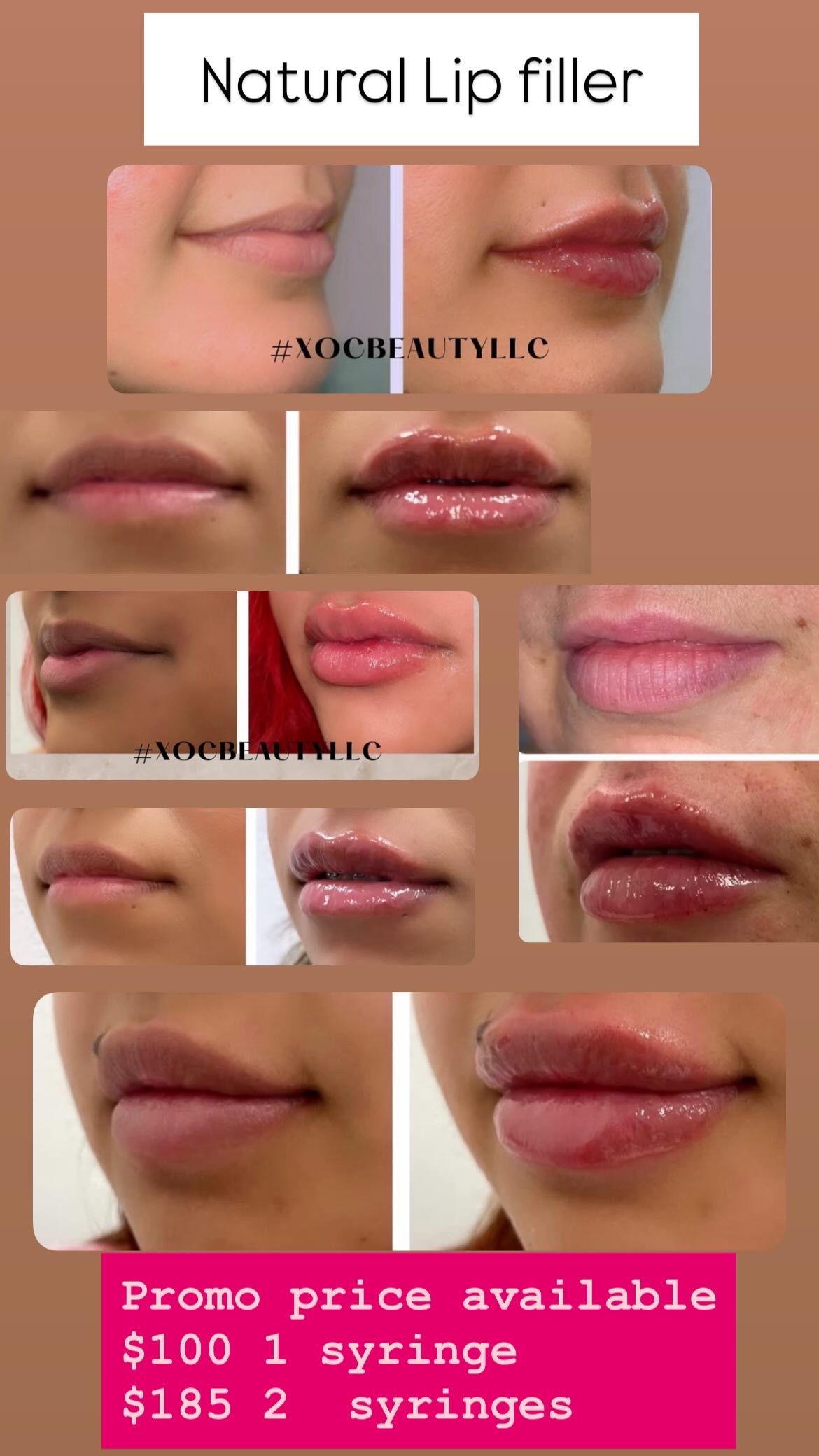 Lip Gloss