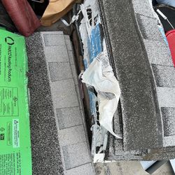 Shingles $25