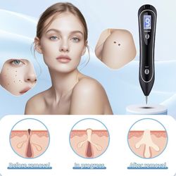 Skin Clinic Freeze Point for Warts and Skin Tags, GJW-02  available 2 $40 each