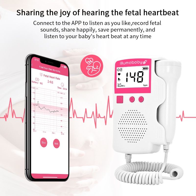 illumababy Rechargeable Baby Doppler Heart Monitor w/ Mobile App