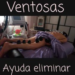 Cupping Therapy Massage
