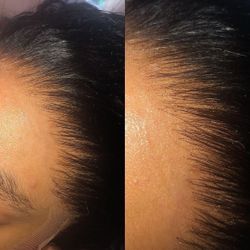 HD LACE  VIRGIN HAIR 