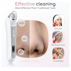 Blackhead Remover Vacuum, Black Head Remover for Face with Camera, Pore Vacuum for Men and Women, USB Interface Type Blackhead Remover Tools, 6 Suctio