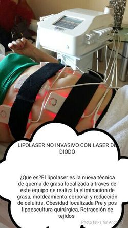 Perdida de Talla con Diodo Lipolaser