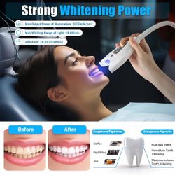 D ental Tooth Bleaching Mobile Teeth Whitening Machine System Whitening T ooth System LED Teeth Whitening Light Lamp, Bleaching Accelerator