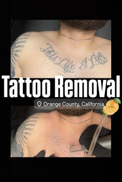 Removal