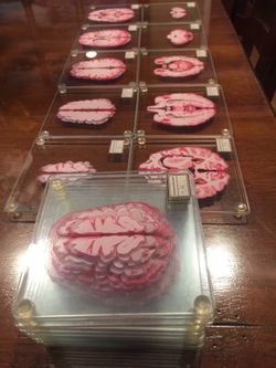 Glass brain coasters