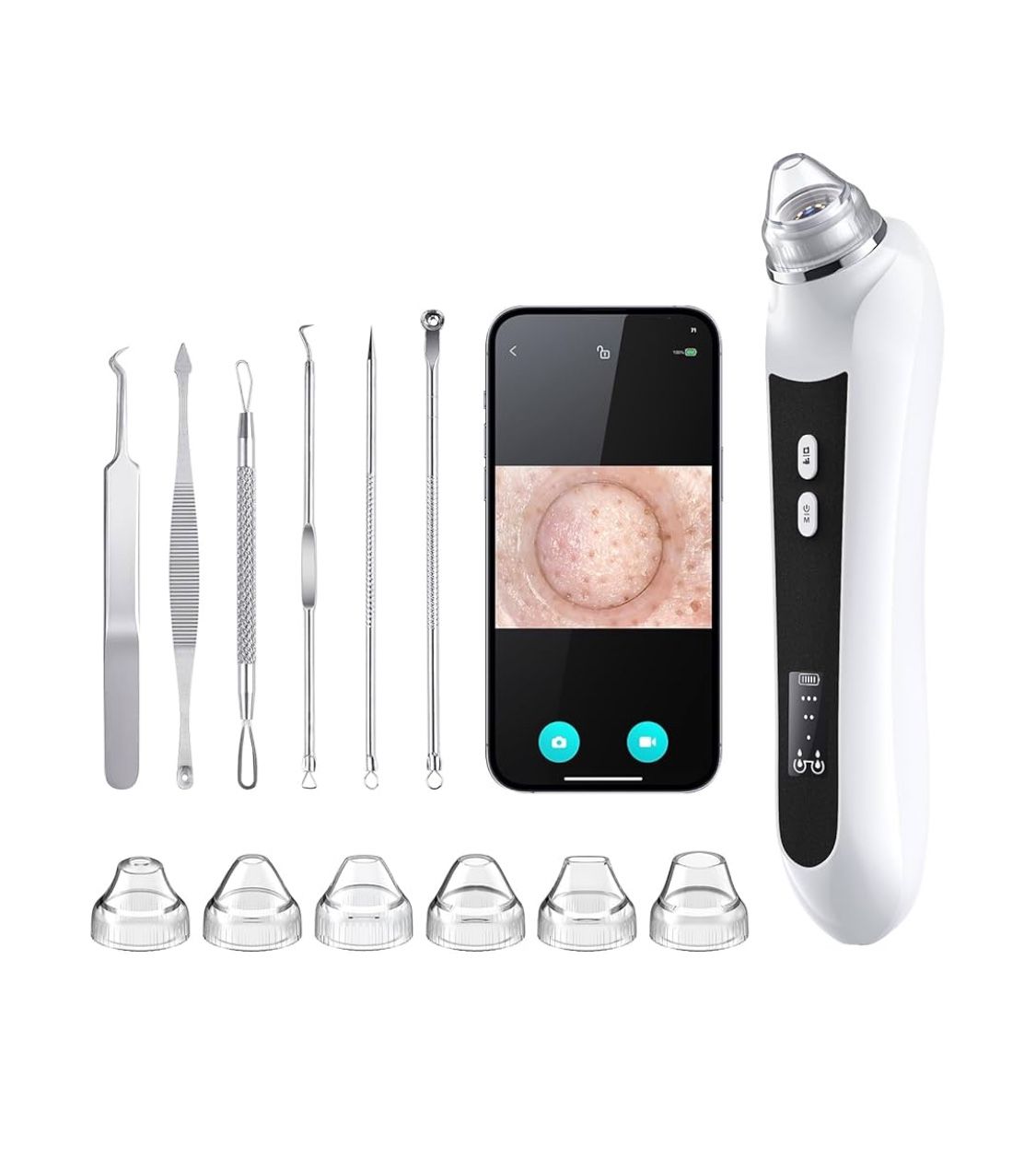 Multi-Functional Blackhead Suction Device With 6 Suction Heads & 3 Modes for Deep Pore Cleaning