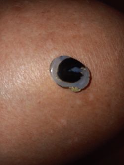 Petrified Stelagtites