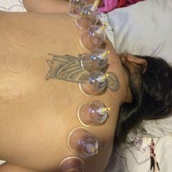 Massage Cupping And More