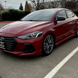 2017 Hyundai Elantra