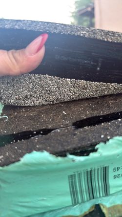 Shingles