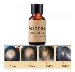 Tratamiento para la calvicie