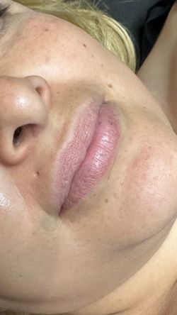 Lipgloss