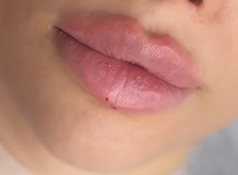Lip 💋 Gloss 💄 MakeUp Lip Plump Labios Lips 💋 Plum