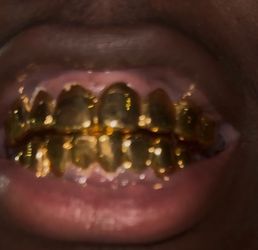 10k-22k grillz and diamonds