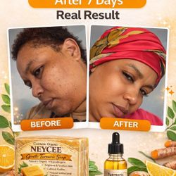 Turmeric Handmade Natural Soap 