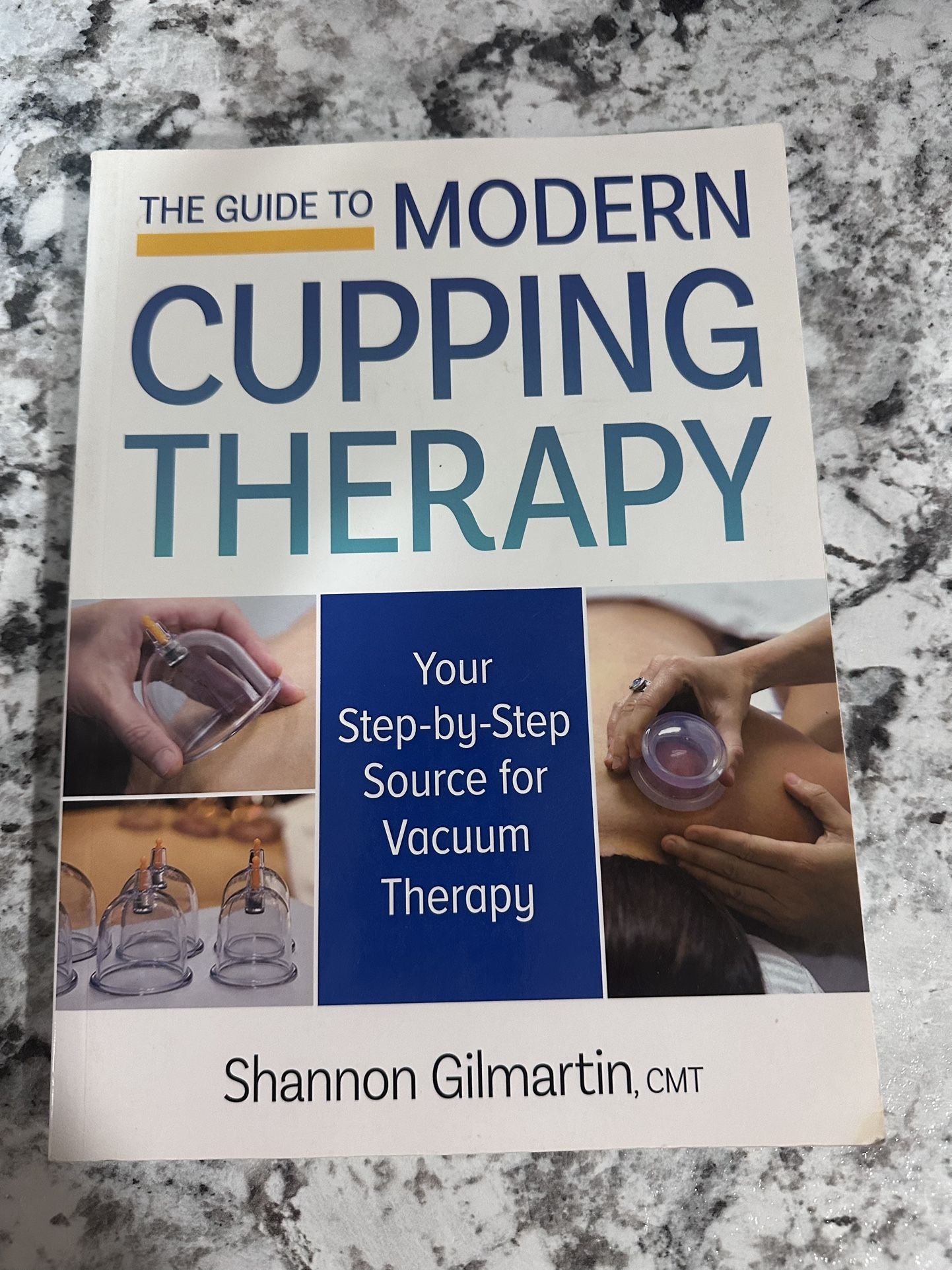 Cupping therapy