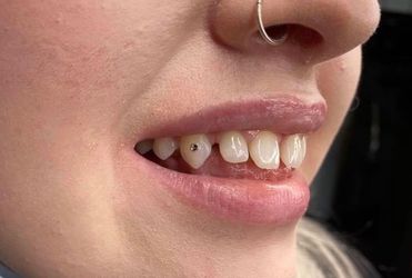 Tooth Gem