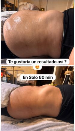 Massages Cavitation