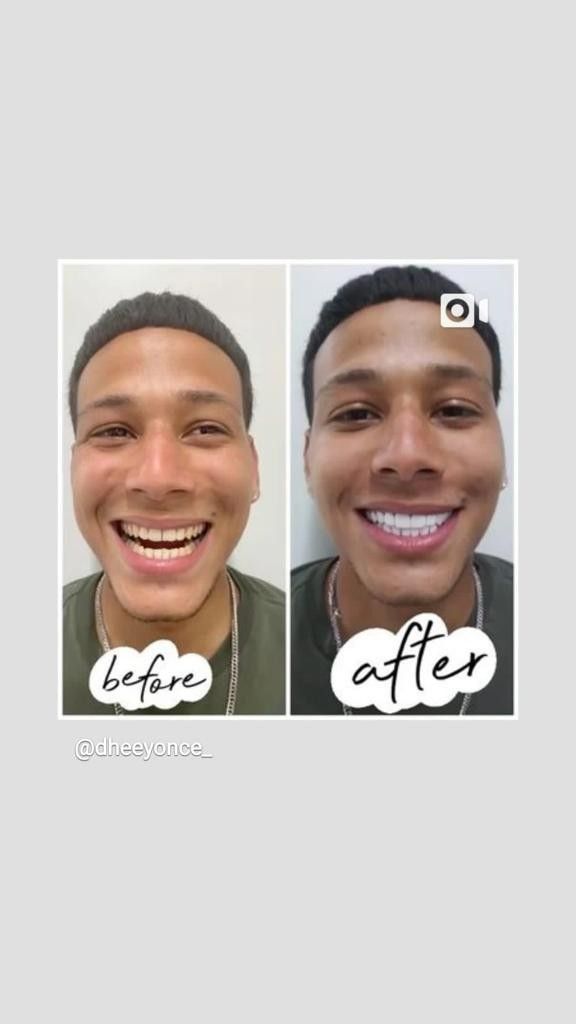 Perfec Smile