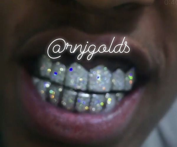 Gold teeth gold grillz diamond VVs for Sale in Oakland Park, FL OfferUp