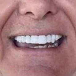 Click-On Smile